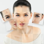 tri seo mun 150x150 - Nguyên nhân và cách trị mụn theo từng vị trí trên khuôn mặt