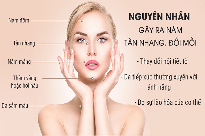 Nhieu tac nhan khien da bi tan nhang - Serum trị nám tàn nhang Hanvely – "siêu phẩm" làm đẹp da cho các nàng