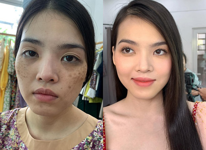 Serum trị nám tàn nhang Hanvely – "siêu phẩm" làm đẹp da cho các nàng Sau khi su dung serum Hanvely da dep trong thay - Serum trị nám tàn nhang Hanvely – "siêu phẩm" làm đẹp da cho các nàng